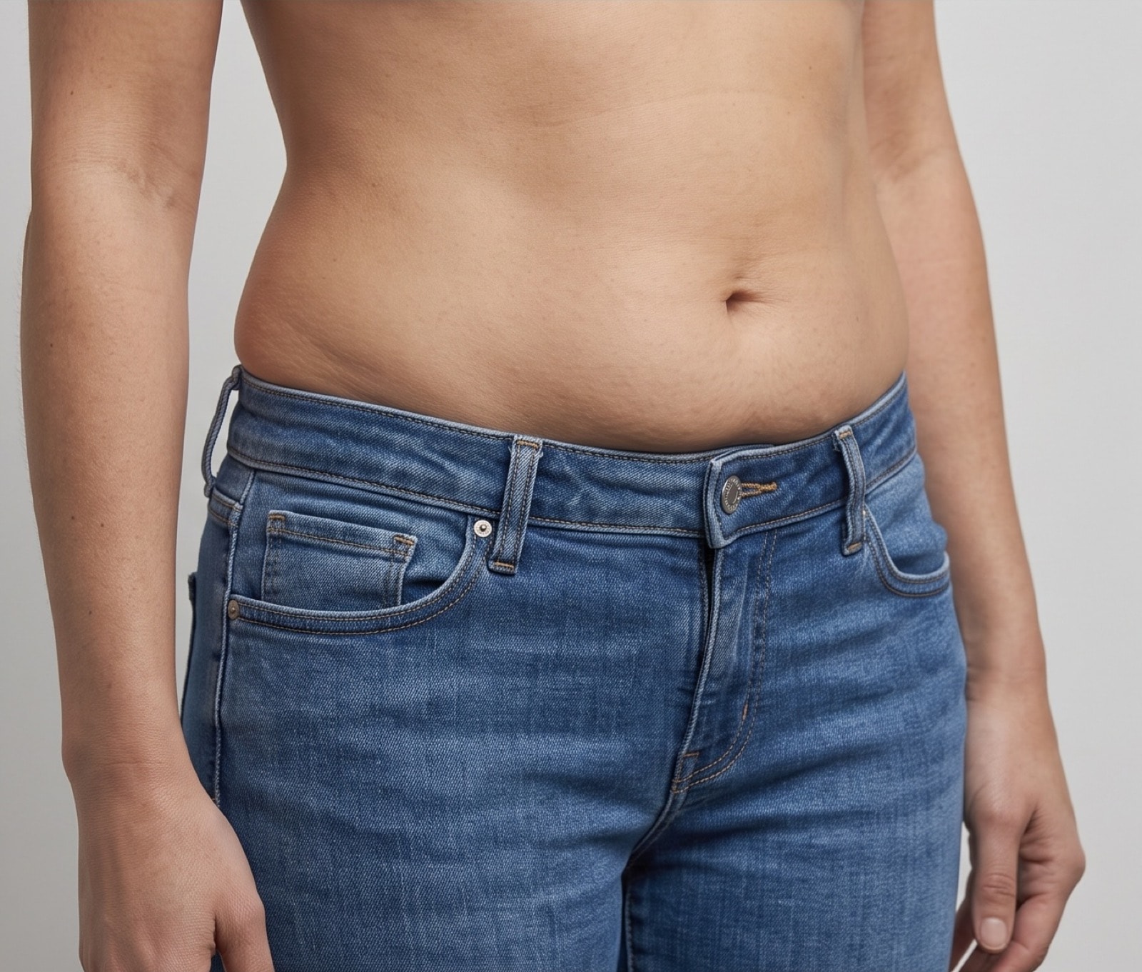 Fat Dissolving — before treatment