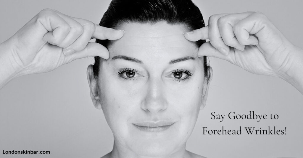 Say Goodbye to Forehead Wrinkles: Effective Treatments That Work